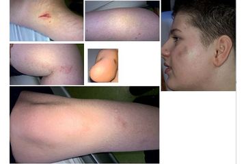Bild der Petition An Spielsucht erkrankter harmloser Junge erleidet Körperverletzungen in Drogen+Gewaltentzugsanstalt