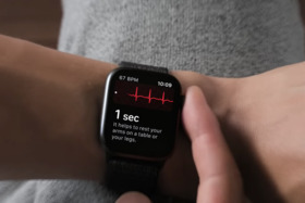 Peticijos nuotrauka:Apple Watch EKG schnell zulassen