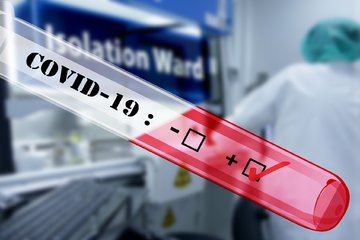 Bild der Petition Bereitstellung von Antikörpertests zur Feststellung von Immunität gegen Sars-Cov2