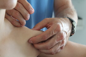 Kép a petícióról:Dry Needling muss in das Berufsbild der Physiotherapie