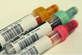 Foto van de petitie:Gegen die bindende Vereinheitlichung der Kappenfarbe von Blutentnahmeröhrchen in der ISO 6710