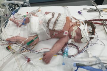 Imagen de la petición Get Our Women And Childrens Services Back At The Alexandra Hospital In Redditch