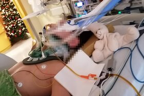 Image of the petition: Keine Straffreiheit / Diversion bei lebensgefährlicher Verletzung eines Kindes