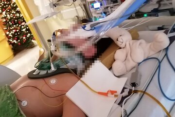 Immagine della petizione Keine Straffreiheit / Diversion bei lebensgefährlicher Verletzung eines Kindes