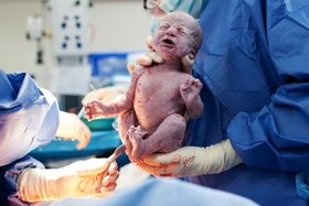 Image of the petition: Omogućiti epiduralnuu OB Dubrovnik u 21.st