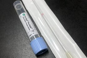 Bild der Petition: Überprüfung der in Deutschland zugelassenen PCR-Tests auf Genauigkeit