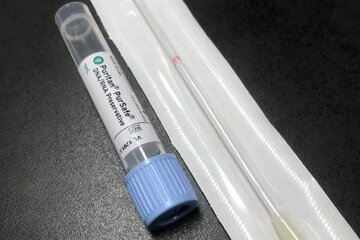 Bild der Petition Überprüfung der in Deutschland zugelassenen PCR-Tests auf Genauigkeit